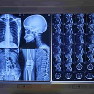 Ffilm X Ray confensiynol